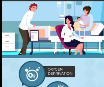 Risk factors of cerebral palsy:  