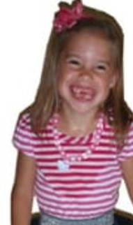 Disfactors of celebral palsy