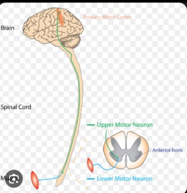 Difference between upper motor lesion lower motor lesion